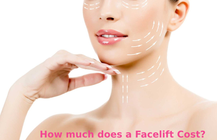 How much does a Facelift Cost?