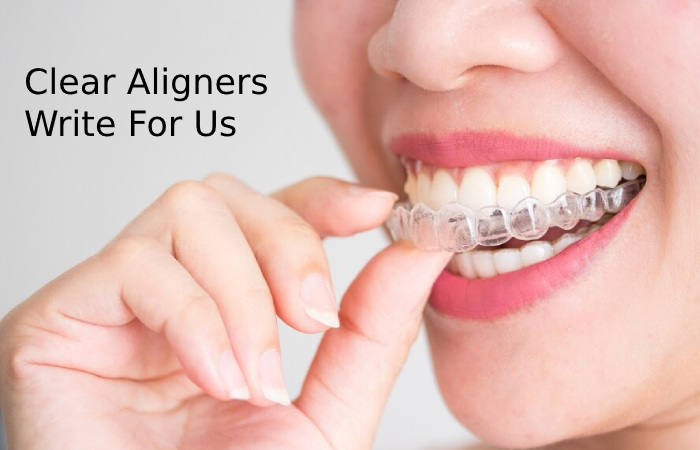 Clear Aligners Write For Us