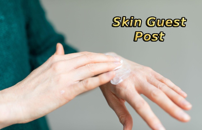 Skin Guest Post