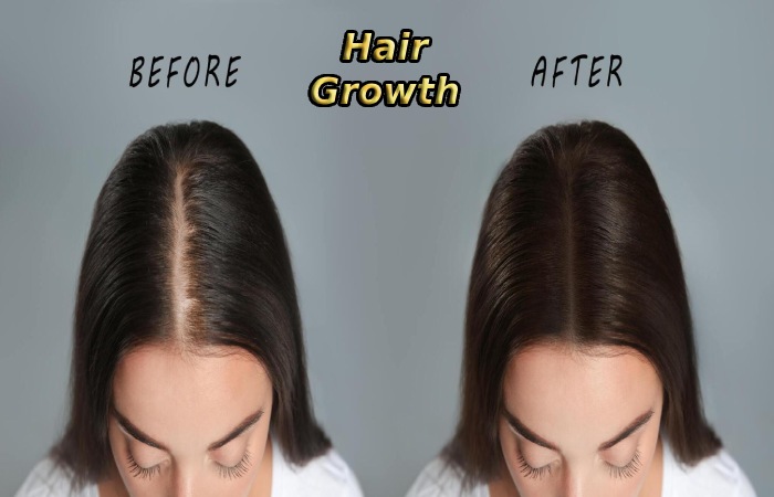 Hair Growth