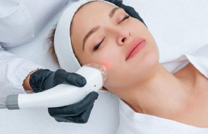 Laser Hair Removal Machines